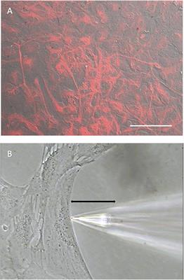 Extracellular ATP-Induced Alterations in Extracellular H+ Fluxes From Cultured Cortical and Hippocampal Astrocytes